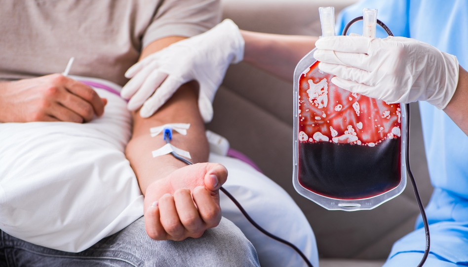 Trasfusione di sangue 3